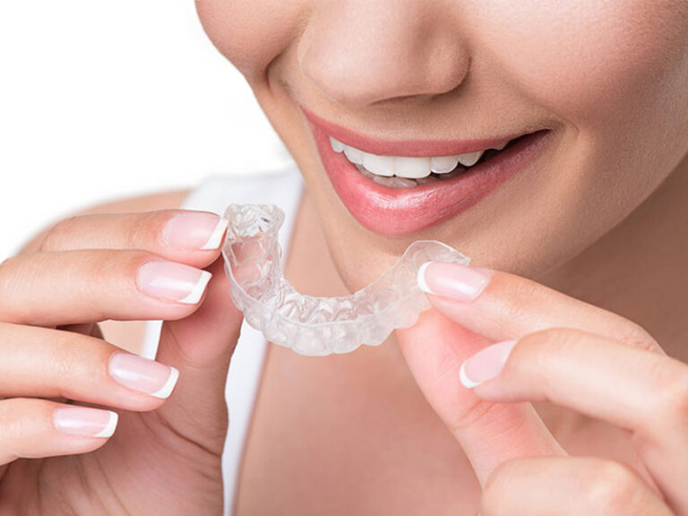 Invisalign